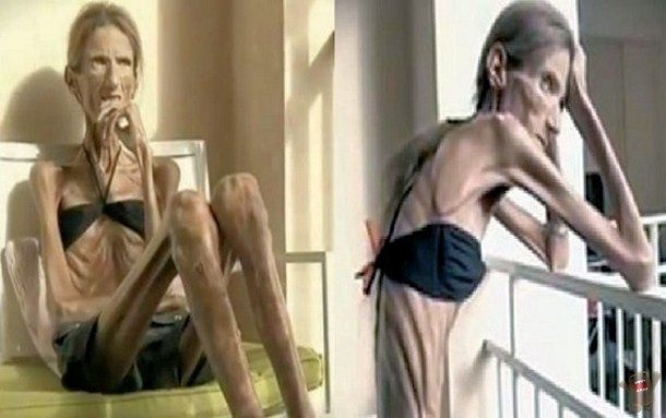 the skinniest person in the world guinness world record