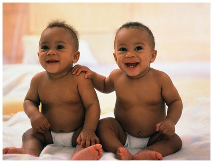 Image result for African identical twins, babies