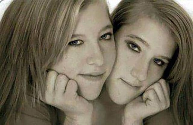 Conjoined twins abby and brittany marriage